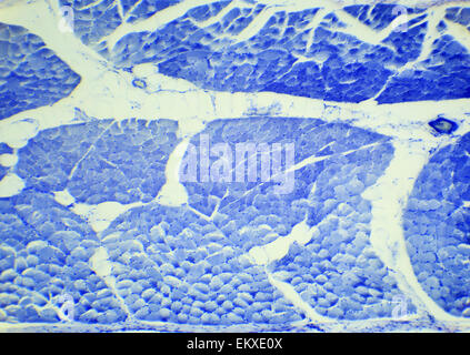 Le taquina le muscle lisse préparation sous un microscope, muscle lisse W.M., 400x Banque D'Images