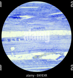 Le tissu musculaire squelettique section longitudinale sous un microscope, muscle squelettique L.S., 400x Banque D'Images