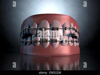 Une sinistre représentation spectaculaire de supérieur et inférieur séparés ensembles de dents humaines à bretelles qui leur sont appliquées sur un étrange sombre spotl Banque D'Images
