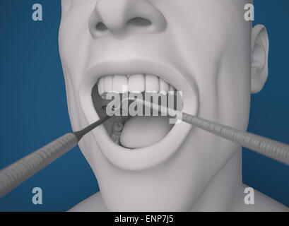 Illustration de l'homme avec l'équipement dentaire en bouche sur fond bleu Banque D'Images