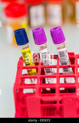 L'analyse du plomb dans le sang (saturnisme). Laboratoire de Toxicologie Analytique de l'environnement et de la santé au travail. Biologie et Centre de recherche. Banque D'Images