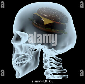 X-ray d'un chef avec le hamburger au lieu du cerveau, 3d illustration Banque D'Images