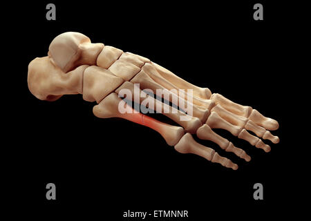 Illustration montrant l'os du pied avec une coupure d'un métatarsien en surbrillance. Banque D'Images