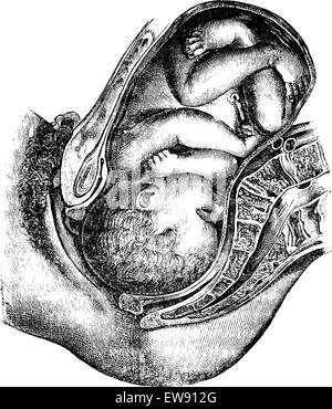 Déjà rempli de rotation, vintage engraved illustration. Magasin Pittoresque 1875. Illustration de Vecteur