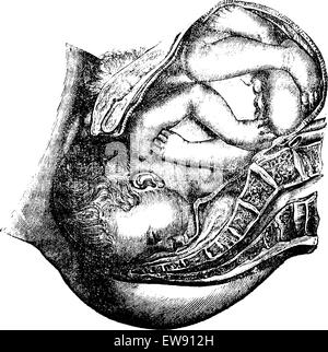 La livraison de la tête, vintage engraved illustration. Magasin Pittoresque 1875. Illustration de Vecteur