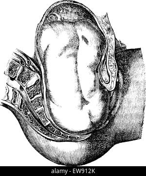 Leur expulsion des fesses, vintage engraved illustration. Magasin Pittoresque 1875. Illustration de Vecteur