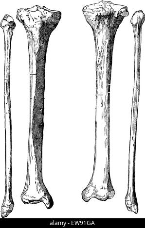 Les os de la jambe, tibia et péroné, vintage engraved illustration. Dictionnaire de médecine habituelle par le Dr Labarthe - 1885 Illustration de Vecteur