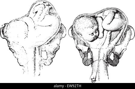 Fig. 1255. Dans la deuxième version de la position de l'épaule gauche, l'introduction de l'entrée des mains et des pieds. Fig. 1256. Dans la version t Illustration de Vecteur