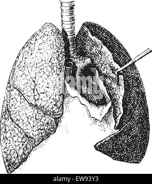 Vieille illustration gravée de poumons humains isolé sur un fond blanc. Dictionnaire des mots et des choses - Larive et Fleury ? 18 Illustration de Vecteur