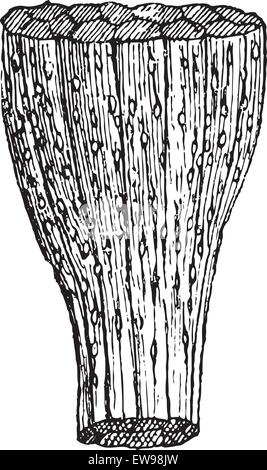 La trichinose, montrant les fibres musculaires infectées par les larves de Trichinella ver, vintage engraved illustration. Dictionnaire de mots Illustration de Vecteur