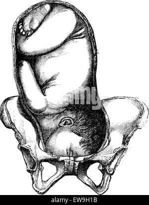 Présentation de la face, du menton vers la droite, vintage engraved illustration. Magasin Pittoresque 1875. Illustration de Vecteur