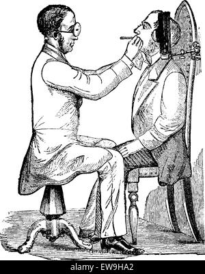 La laryngoscopie, montrant un médecin regardant dans une bouche du patient, éclairé par la lumière indirecte d'une lampe à gaz, j'ai gravée vintage Illustration de Vecteur