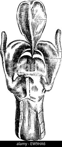 Vue postérieure du larynx montrant les cartilages du larynx, vintage engraved illustration. Dictionnaire de médecine habituelle par le Dr Labart Illustration de Vecteur