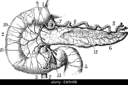 Le pancréas et le duodénum vu par leur aspect antérieur, vintage engraved illustration. Dictionnaire de médecine habituelle - Paul Labarthe - Illustration de Vecteur