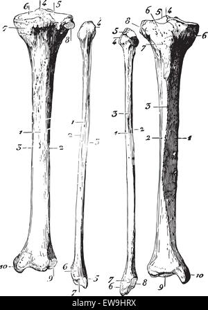 Squelette de la jambe, vintage engraved illustration. Dictionnaire de médecine habituelle - Paul Labarthe - 1885. Illustration de Vecteur