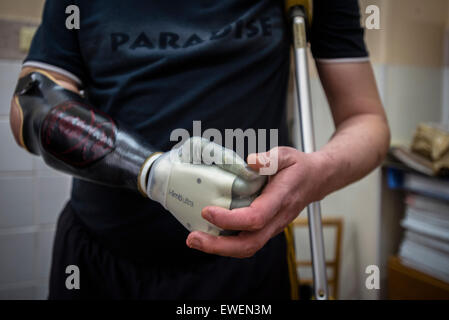 Stuzhenko soldat ukrainien Vasyl, qui a perdu son bras et une jambe lors de combats près de Illovaisk dans la région de Donetsk en août dernier, a choisi sa nouvelle main bionique, doué par l'Ukraine dans le cadre du projet d'aide prothétique, projet de charité organisé par l'ukrainien et les travailleurs médicaux et les personnalités publiques pour transférer les connaissances et la réhabilitation prothétique de spécialistes américains et canadiens à leurs collègues en Ukraine. Au cours de projet cinq ukrainiens ont reçu une prothèse bionique de haute qualité, dont trois soldats ukrainiens ont perdu leurs membres dans les batailles. Kiev, Ukraine. Banque D'Images