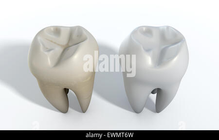 Une comparaison entre une dent et une sale dent blanche sur un fond studio isolé Banque D'Images