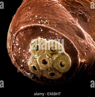 Ou Pediculus humanus capitis, poux de tête détail des oeufs, SEM Banque D'Images