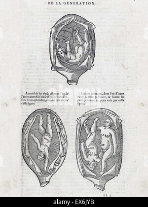 Illustration de 'Les oeuures d'Ambroise Pare ?' 1585 par Ambroise Pare ?, chirurgien et anatomiste français 1510-1590 Banque D'Images