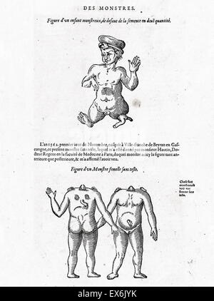 Illustration de 'Les oeuures d'Ambroise Pare ?' 1585 par Ambroise Pare ?, chirurgien et anatomiste français 1510-1590 Banque D'Images