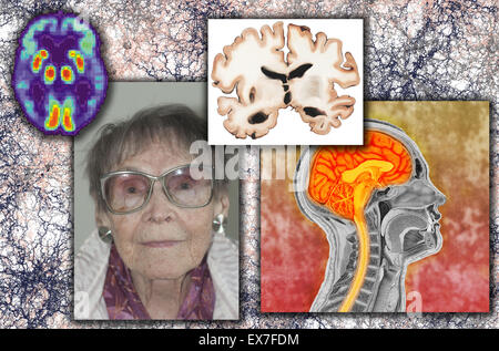 Illustration de l'antique colorisée le cerveau humain Banque D'Images
