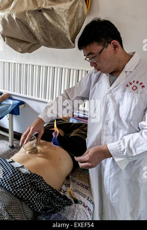 Hua County, Henan, CHN. 11 juillet, 2015. Hua County, CHINE - 11 juillet 2015 : (usage éditorial uniquement. Chine OUT) Un homme est en train de faire saigner la thérapie. Comme le chien jours viennent en Chine, les gens s'entassant dans les hôpitaux MTC pour prévenir ou réduire la gravité des maux de l'hiver. ''Traitement des maladies de l'hiver à l'été'' est une tradition ancienne. C'est l'heure de rituel annuel de la médecine traditionnelle chinoise - obtenir des packs, des décoctions et l'acupuncture en été pour rester en bonne santé en hiver. © SIPA Asie/ZUMA/Alamy Fil Live News Banque D'Images
