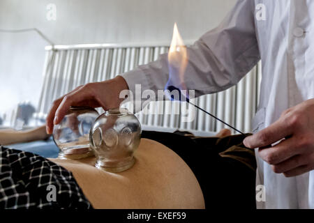 Hua County, Henan, CHN. 11 juillet, 2015. Hua County, CHINE - 11 juillet 2015 : (usage éditorial uniquement. Chine OUT) Un homme est en train de faire saigner la thérapie. Comme le chien jours viennent en Chine, les gens s'entassant dans les hôpitaux MTC pour prévenir ou réduire la gravité des maux de l'hiver. ''Traitement des maladies de l'hiver à l'été'' est une tradition ancienne. C'est l'heure de rituel annuel de la médecine traditionnelle chinoise - obtenir des packs, des décoctions et l'acupuncture en été pour rester en bonne santé en hiver. © SIPA Asie/ZUMA/Alamy Fil Live News Banque D'Images