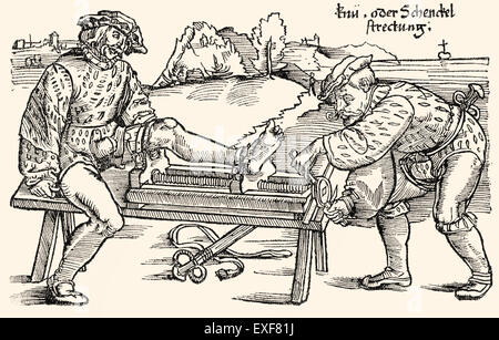 Extension de la jambe s'étend sur un rack, thérapie orthopédique, gravure sur bois de 'Feldtbuch der Wundartzney" par Hans von Gersdorff, 1528 Banque D'Images