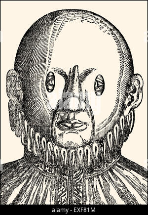 Traitement de l'Œil, le strabisme, les yeux croisés, Georg Bartisch Ophthalmodouleia, 1583, Banque D'Images