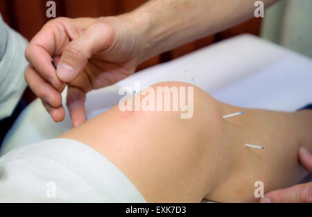 Médecin utilise les aiguilles d'acupuncture sur le genou d'une femme Banque D'Images