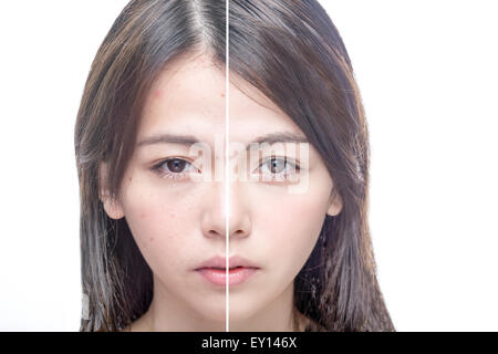 Asian woman's face, beauté concept, avant et après Banque D'Images