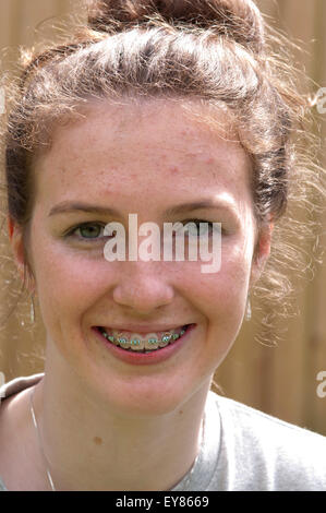 Portrait of teenage girl with braces smiling Banque D'Images