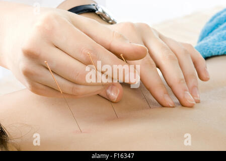 Très proche de l'acupuncture , photo horizontale Banque D'Images