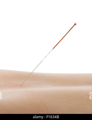 L'acupuncture, l'aiguille dans le dos, la peau, isolé sur fond blanc Banque D'Images