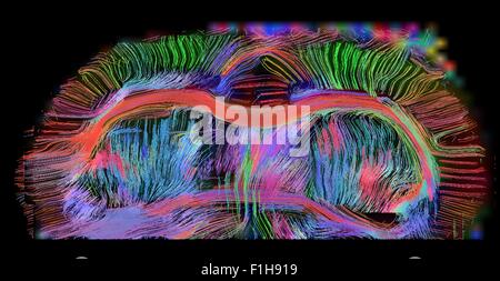 Vue axiale de la connectivité du cerveau de rat. corps calleux est antérieur connexions commisures matière grise. Images 300 microns Banque D'Images