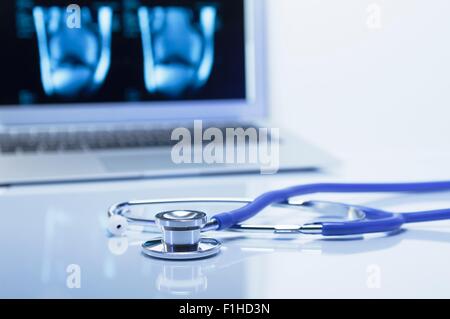 L'orthopédie moderne. Stéthoscope acoustique et un ordinateur portable affichant des images IRM d'un genou Banque D'Images