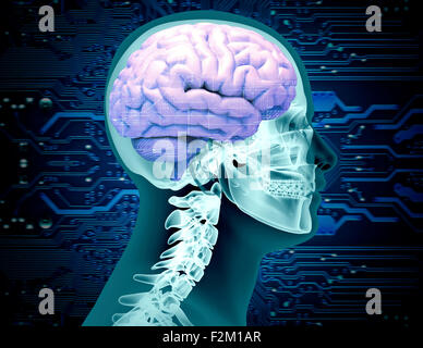 X-ray image d'un crâne avec un cerveau et la platine de puce. Banque D'Images