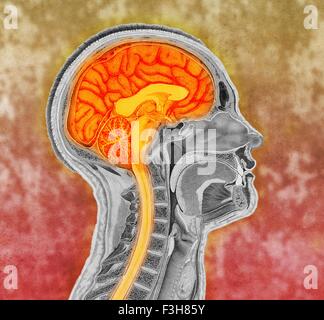 Illustration de l'antique colorisée le cerveau humain Banque D'Images