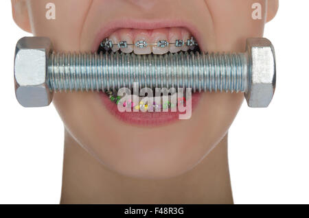 Dents avec accolades métalliques comprimé visser Banque D'Images