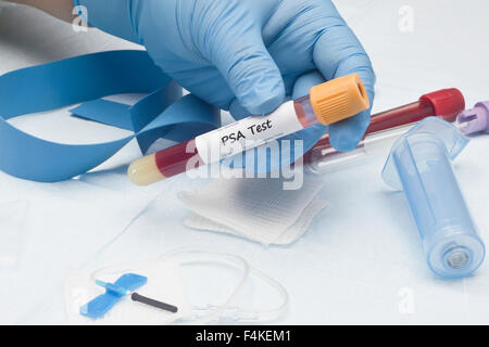 L'antigène prostatique spécifique sanguin PSA tube de collecte d'échantillon de culture Banque D'Images