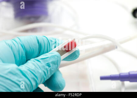 Close-up of nurse réglage régulateur de débit sur sac d'alimentation entérale. Banque D'Images