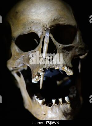 Le crâne de autour de 3499 B.C. d'un homme d'environ 35-40 ans avec un billet dans le visage peut être vu dans le musée d'état de la Préhistoire à Halle/Saale, Allemagne, 05 novembre 2015. La nouvelle exposition temporaire "Guerre - décodage ses traces archéologiques' ouvre 06 novembre 2015. Autour de 900 produits à partir de l'âge de pierre jusqu'à la guerre de Trente ans s'affiche. Photo : HENDRIK SCHMIDT/dpa Banque D'Images