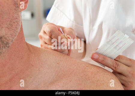 Un traitement d'acupuncture Banque D'Images