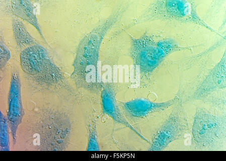 Les cellules du cancer du col de HeLa, tachés de bleu de Coomassie, sous microscope à contraste d'interférence inductances. Banque D'Images