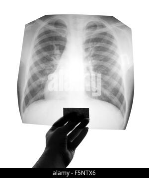 La radiographie du thorax droit dans la main Banque D'Images