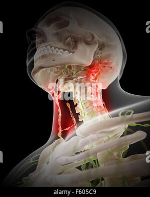 Illustration - médicalement exacts des nœuds lymphatiques douloureux Banque D'Images