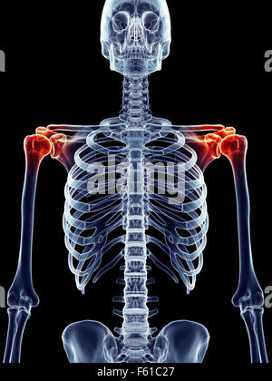 Illustration - médicalement exacts de l'épaule douloureuse Banque D'Images
