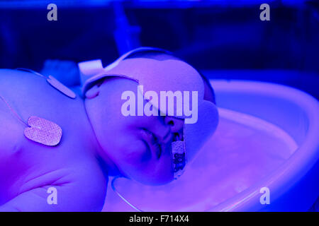 Un bébé prématuré est traité avec la lumière ultra-violette dans un incubateur de l'hôpital Banque D'Images