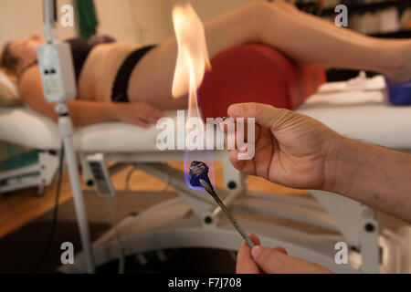 Reportage sur un thérapeute qui se spécialise dans la médecine traditionnelle chinoise. Le thérapeute combine les aiguilles et la moxibustion, chauffage les aiguilles aux points d'acupuncture permet d'être stimulé plus Banque D'Images