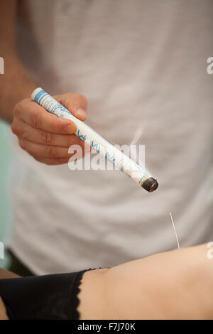 Reportage sur un thérapeute qui se spécialise dans la médecine traditionnelle chinoise. Le thérapeute combine les avantages de l'aiguilles avec la moxibustion. Banque D'Images